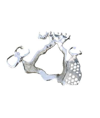 Protesi scheletrata