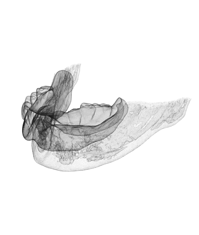 Implantologia digitale